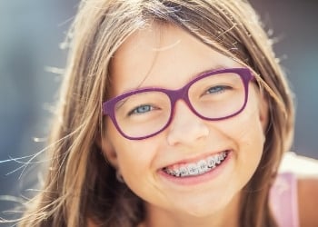 Aplicativo para simular aparelho dentário