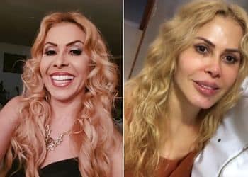Os melhores aplicativos para rejuvenescer suas fotos